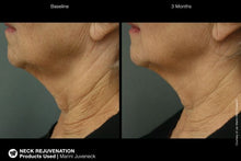Load image into Gallery viewer, Jan Marini Juveneck Neck creme before and after 3 months
